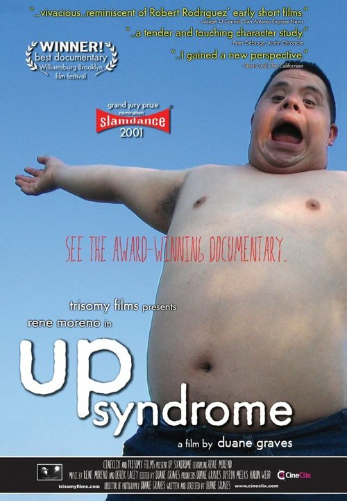 Up Syndrome mp4